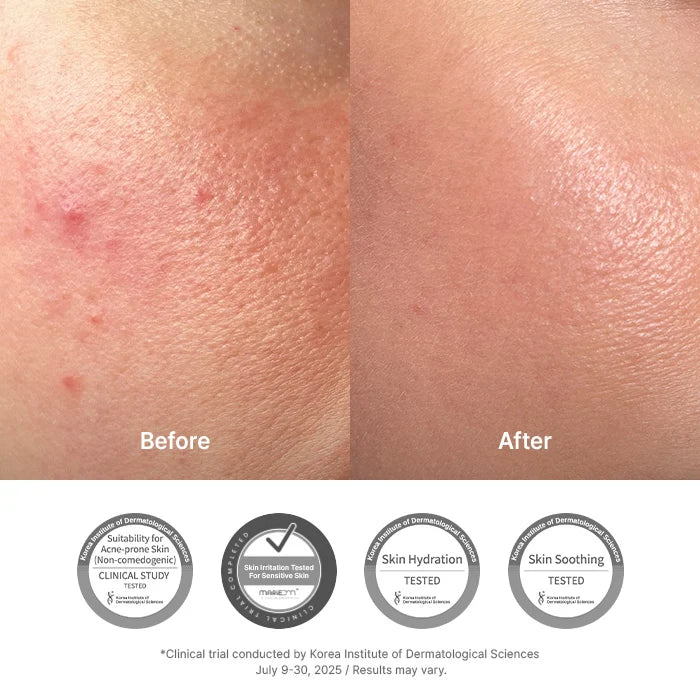 Soothing and hydrating face cream for damaged skin barrier